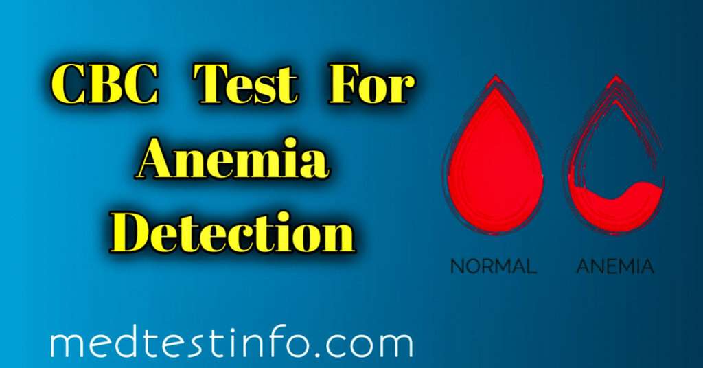 cbc test in detecting anemia, importance of the cbc test, complete blood count, cbc test, red blood cells, hemoglobin, iron deficiency anemia, vitamin deficiency anemia, low rbc count, iron rich diets