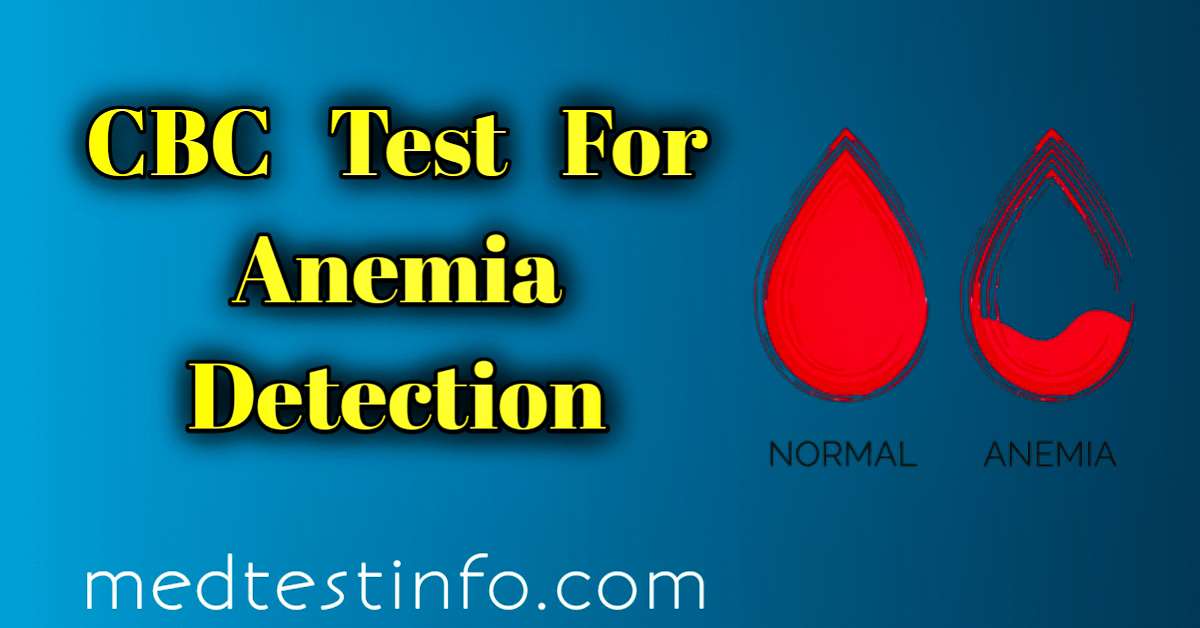 Understanding The Importance Of The CBC Test In Detecting Anemia